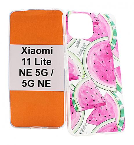 billigamobilskydd.seDesignskal TPU Xiaomi 11 Lite NE 5G / 11 Lite 5G NE