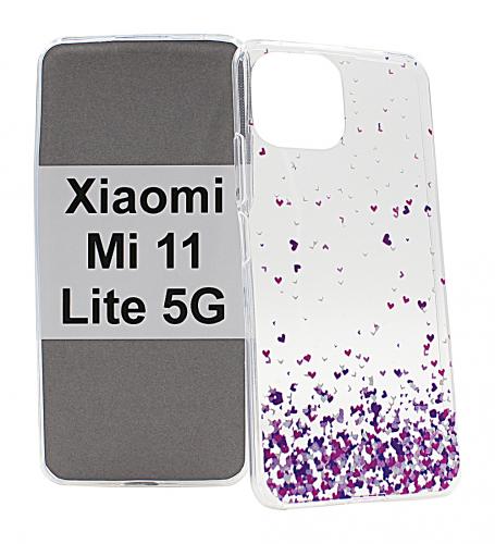 Designskal TPU Xiaomi Mi 11 Lite / Mi 11 Lite 5G