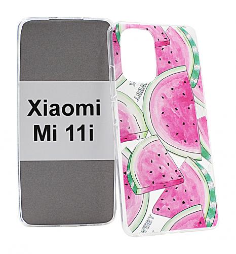 billigamobilskydd.seDesignskal TPU Xiaomi Mi 11i