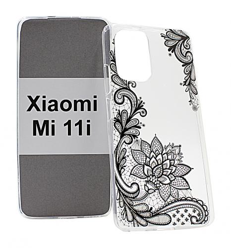 billigamobilskydd.seDesignskal TPU Xiaomi Mi 11i