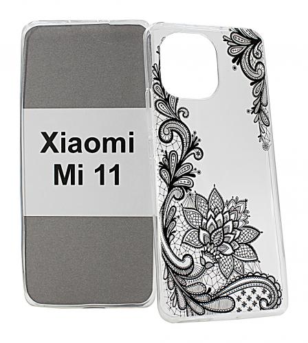 billigamobilskydd.seDesignskal TPU Xiaomi Mi 11