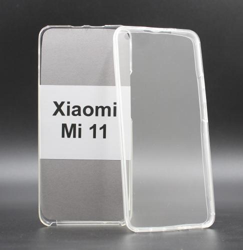 billigamobilskydd.seFront & Back skal Xiaomi Mi 11