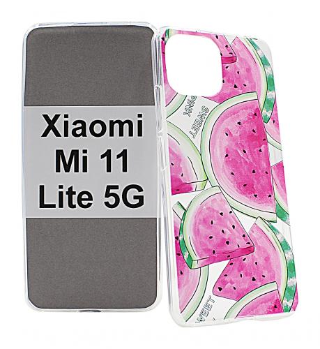 billigamobilskydd.seDesignskal TPU Xiaomi Mi 11 Lite / Mi 11 Lite 5G