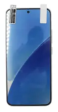 Skärmskydd Xiaomi 15