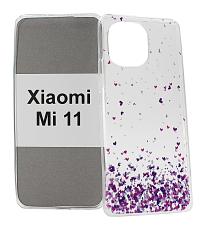 billigamobilskydd.seDesignskal TPU Xiaomi Mi 11