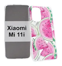 Designskal TPU Xiaomi Mi 11i