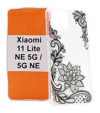 Designskal TPU Xiaomi 11 Lite NE 5G / 11 Lite 5G NE